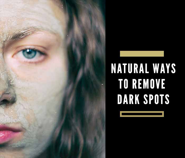 How to Remove Dark Spots on Face Fast Naturally